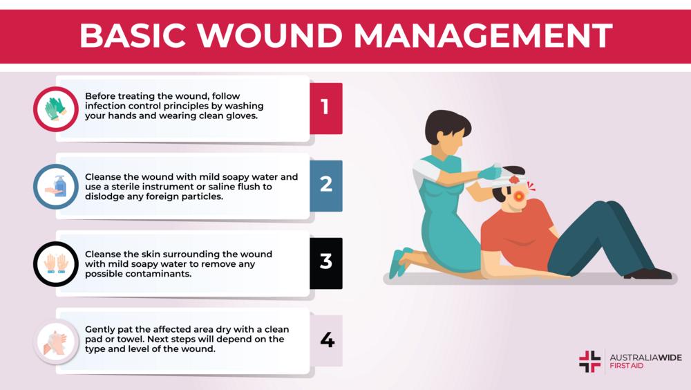 Basics of Injury Management