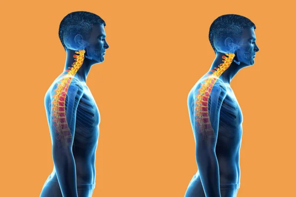 Posture for neck