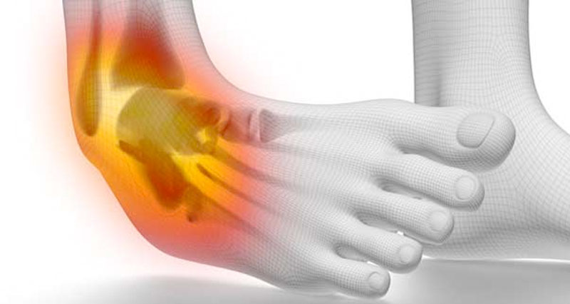 Acute Injuries