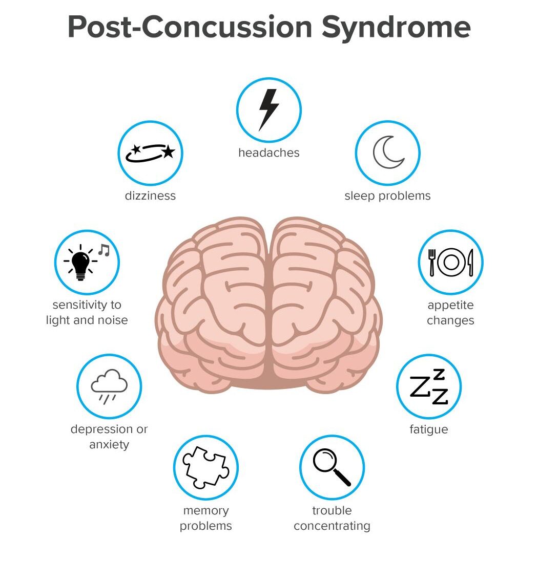 Post concussion syndrome
