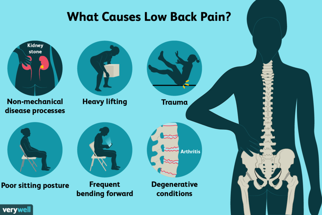 causes of backpain