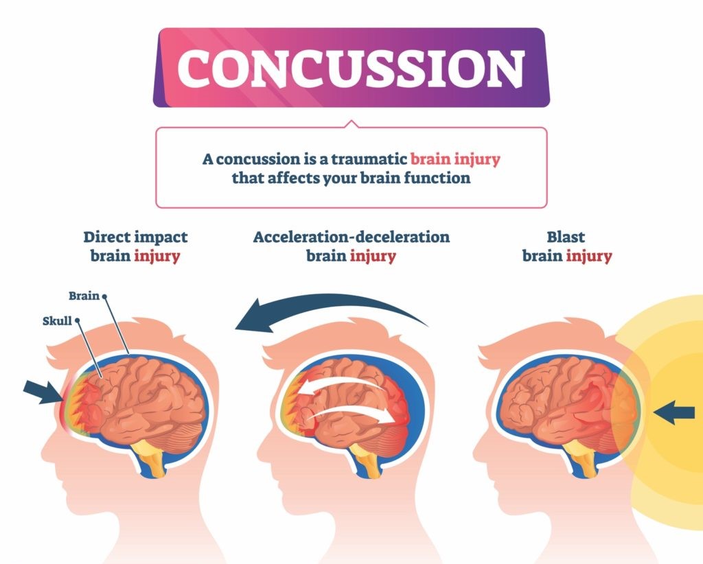 how a concussion affects the brain