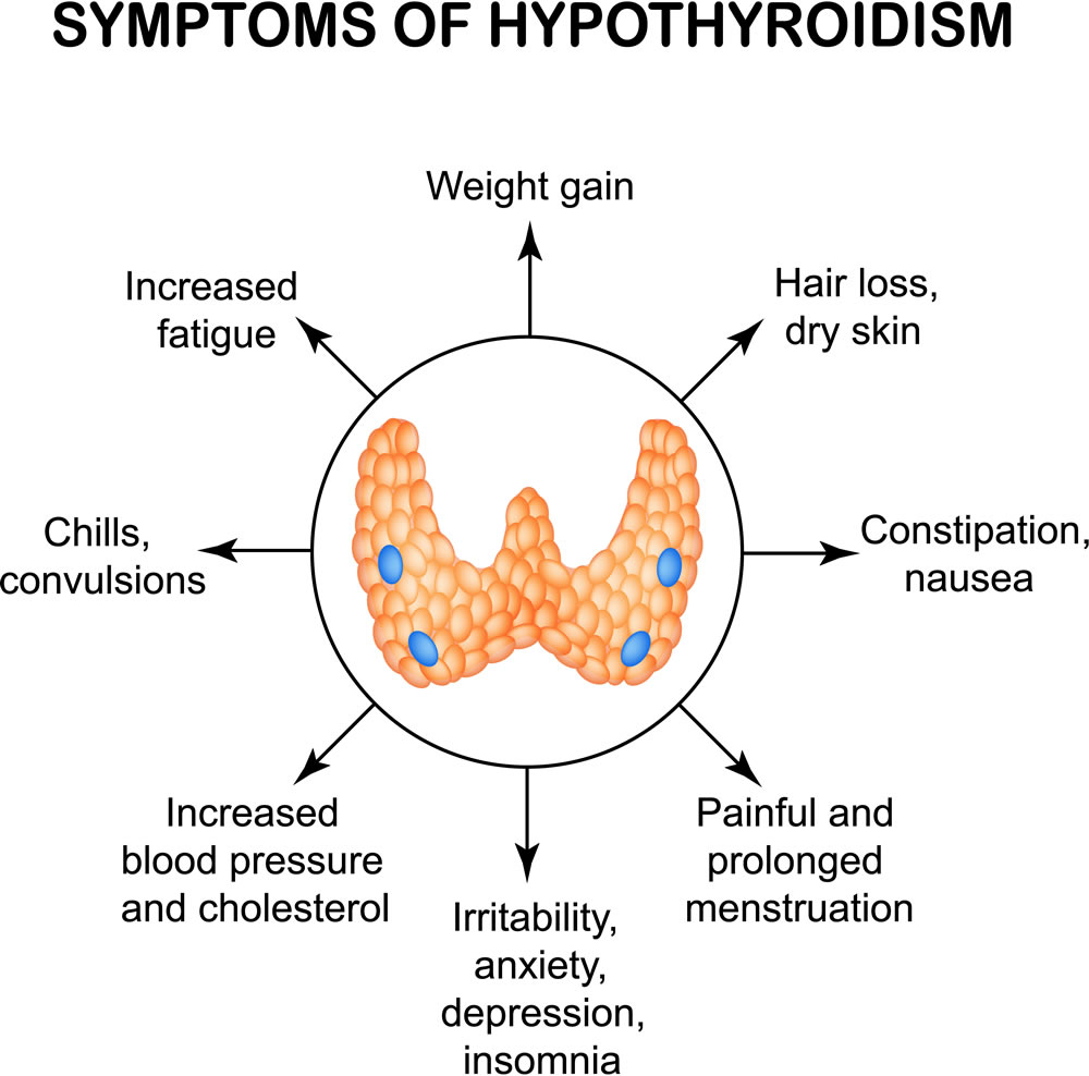 hypothyroidism