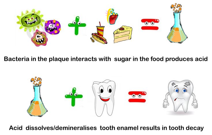 process of tooth decay caused by sugar