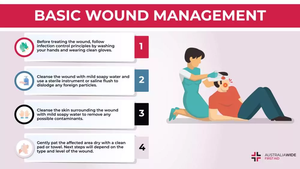 Basics of Injury Management